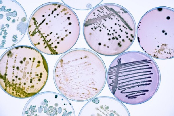 cara menggunakan cawan petri dalam mikrobiologi